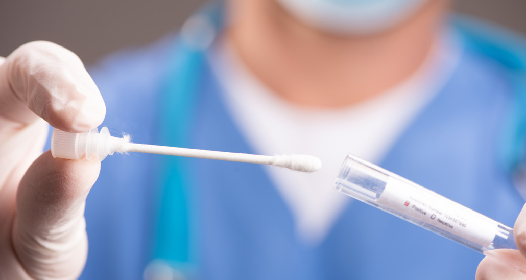 Scontro governo-sindacati su tamponi gratis