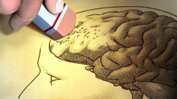 Un esame dell’occhio a 45 anni, per predire il rischio di Alzheimer