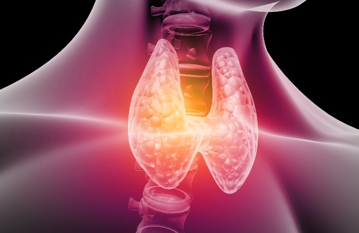 Tumore alla tiroide: quando la prevenzione gioca un ruolo fondamentale per la diagnosi precoce e terapia mirata