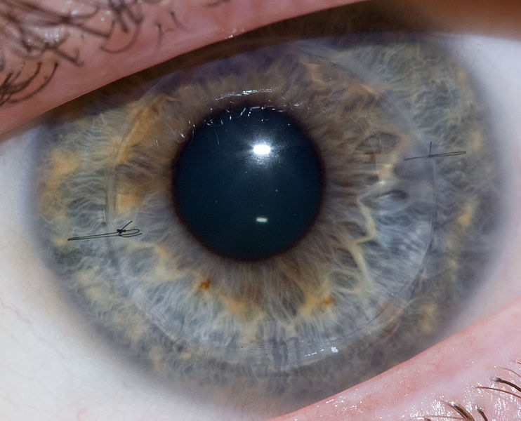 Trapianto cornea addio, nel 40% dei casi basterà iniezione delle cellule