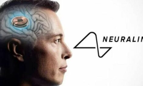Musk: “Neuralink ha installato il primo impianto cerebrale su essere umano”