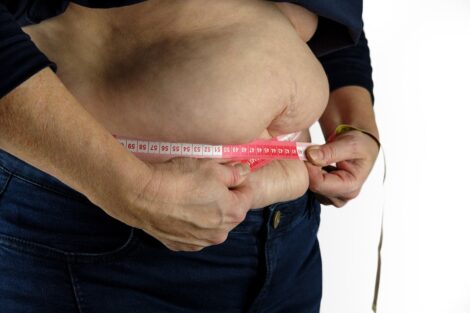 Giornata Mondiale dell’Obesità: un’epidemia con 800 milioni di malati
